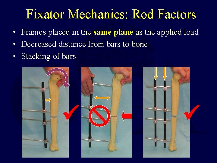 Fixator Mechanics: Rod Factors • Frames placed in the same plane as the applied