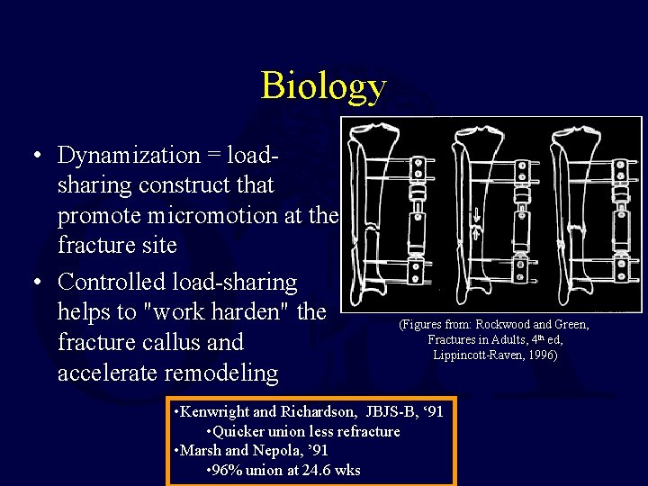 Biology • Dynamization = loadsharing construct that promote micromotion at the fracture site •