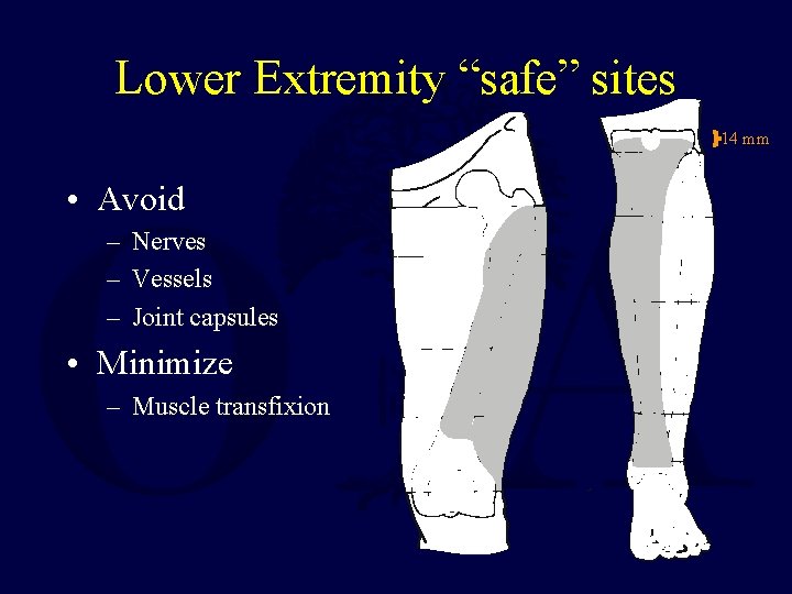 Lower Extremity “safe” sites 14 mm • Avoid – Nerves – Vessels – Joint