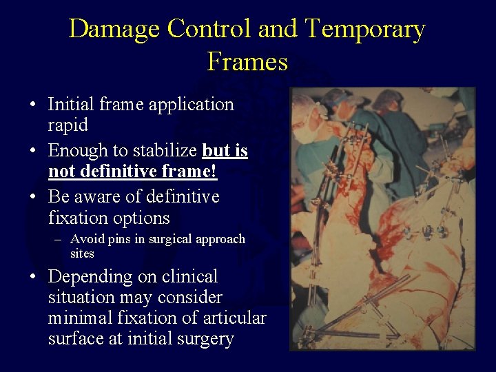 Damage Control and Temporary Frames • Initial frame application rapid • Enough to stabilize