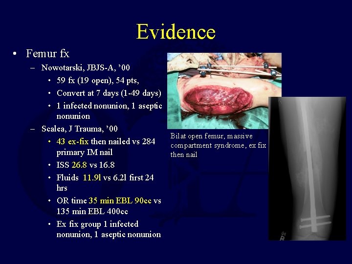 Evidence • Femur fx – Nowotarski, JBJS-A, ’ 00 • 59 fx (19 open),