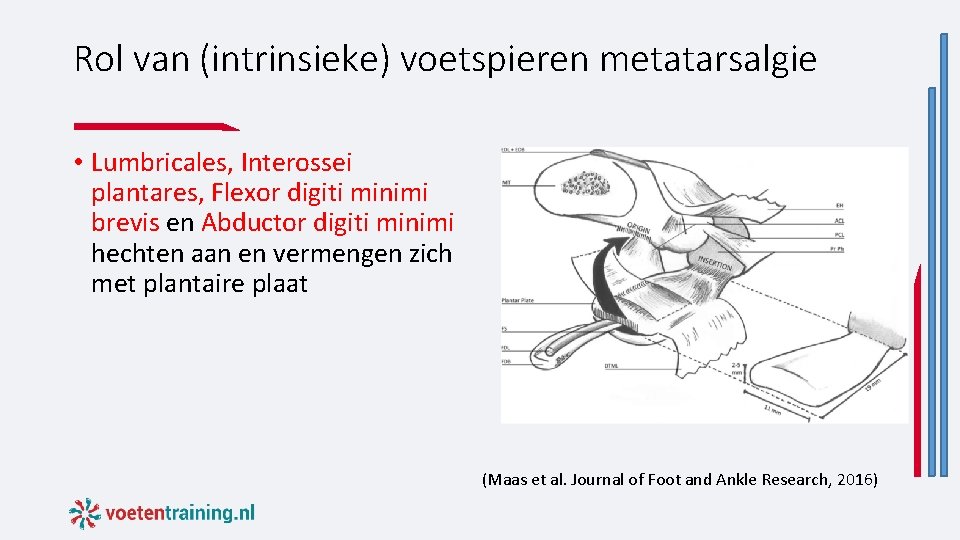 Rol van (intrinsieke) voetspieren metatarsalgie • Lumbricales, Interossei plantares, Flexor digiti minimi brevis en Rol van (intrinsieke) voetspieren metatarsalgie • Lumbricales, Interossei plantares, Flexor digiti minimi brevis en