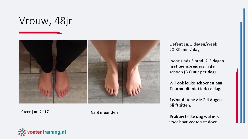 Vrouw, 48 jr Oefent ca. 5 dagen/week 20 -30 min. / dag. loopt sinds Vrouw, 48 jr Oefent ca. 5 dagen/week 20 -30 min. / dag. loopt sinds