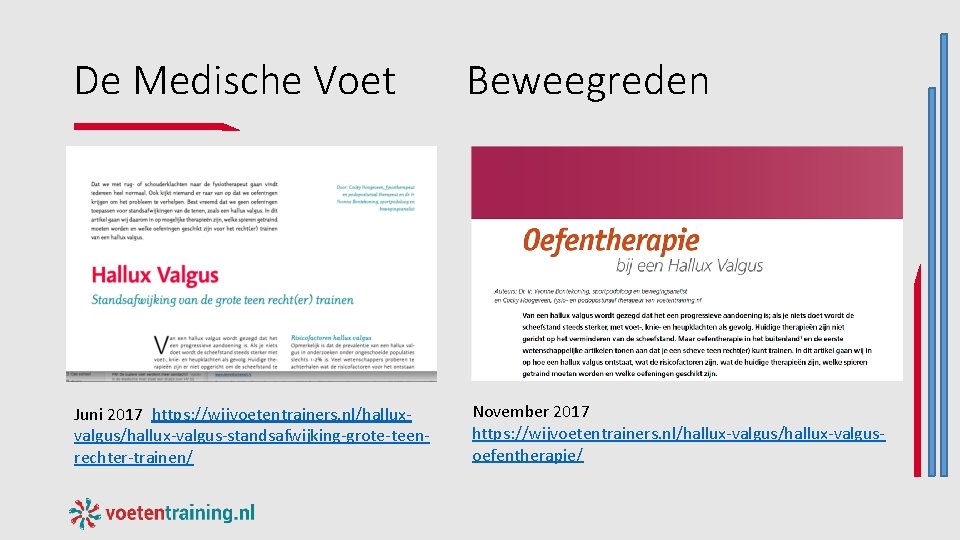 De Medische Voet Juni 2017 https: //wijvoetentrainers. nl/halluxvalgus/hallux-valgus-standsafwijking-grote-teenrechter-trainen/ Beweegreden November 2017 https: //wijvoetentrainers. nl/hallux-valgusoefentherapie/ De Medische Voet Juni 2017 https: //wijvoetentrainers. nl/halluxvalgus/hallux-valgus-standsafwijking-grote-teenrechter-trainen/ Beweegreden November 2017 https: //wijvoetentrainers. nl/hallux-valgusoefentherapie/
