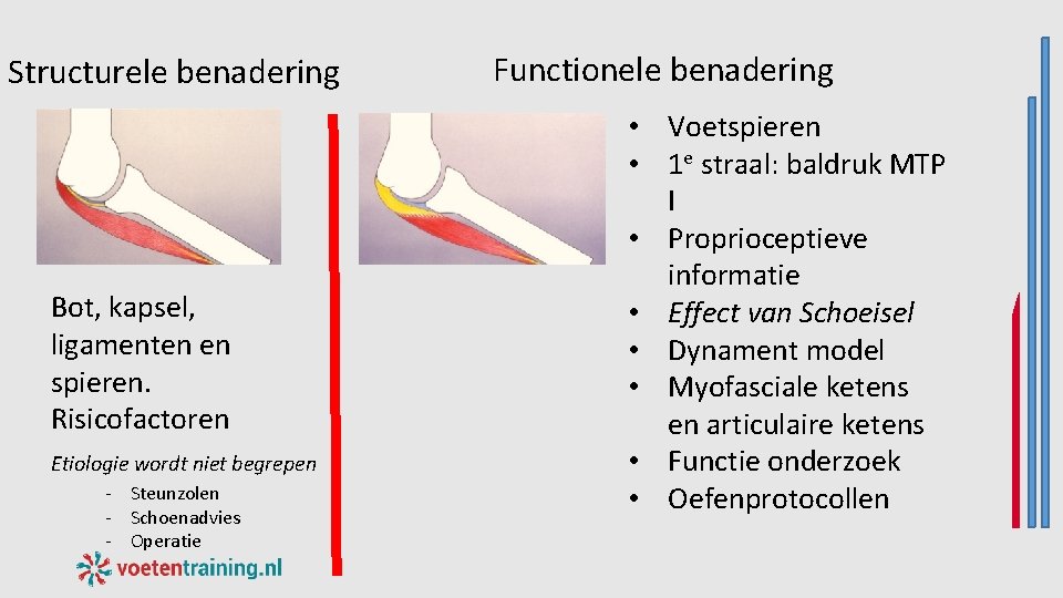 Structurele benadering Bot, kapsel, ligamenten en spieren. Risicofactoren Etiologie wordt niet begrepen - Steunzolen Structurele benadering Bot, kapsel, ligamenten en spieren. Risicofactoren Etiologie wordt niet begrepen - Steunzolen