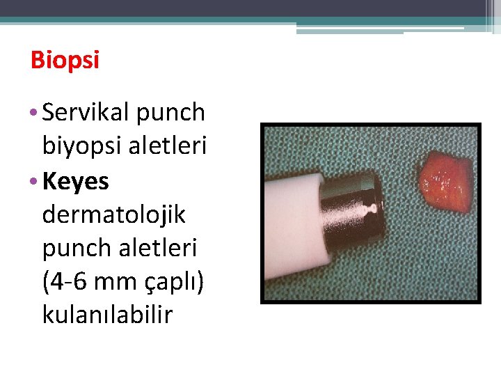 Biopsi • Servikal punch biyopsi aletleri • Keyes dermatolojik punch aletleri (4 -6 mm Biopsi • Servikal punch biyopsi aletleri • Keyes dermatolojik punch aletleri (4 -6 mm