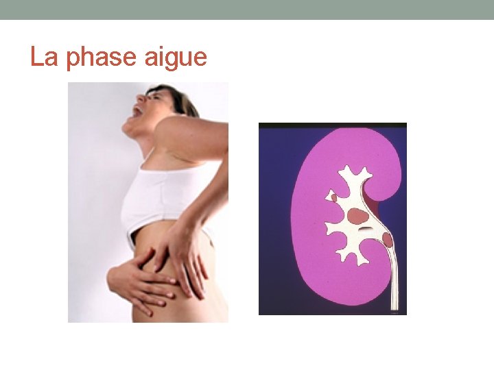 La phase aigue 