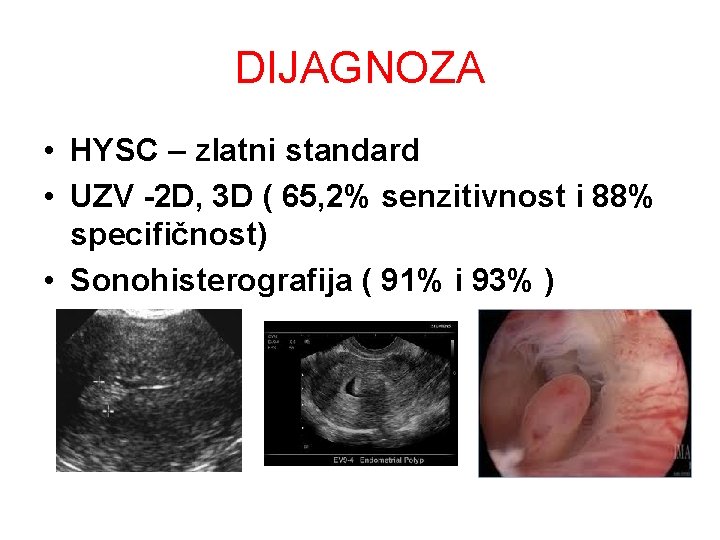 DIJAGNOZA • HYSC – zlatni standard • UZV -2 D, 3 D ( 65, DIJAGNOZA • HYSC – zlatni standard • UZV -2 D, 3 D ( 65,
