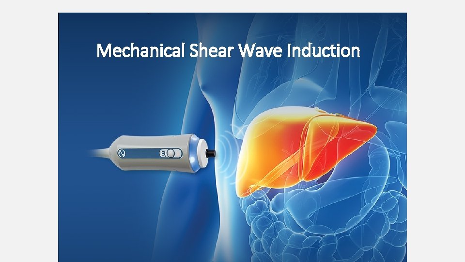 Mechanical Shear Wave Induction 