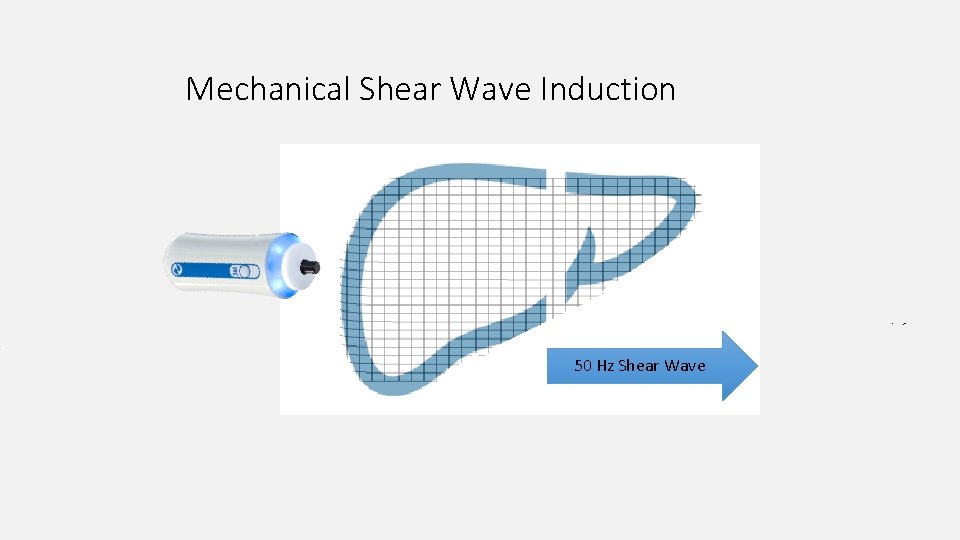 Mechanical Shear Wave Induction 50 Hz Shear Wave 