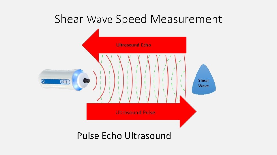 Shear Wave Speed Measurement Ultrasound Echo Shear Wave Ultrasound Pulse Echo Ultrasound 