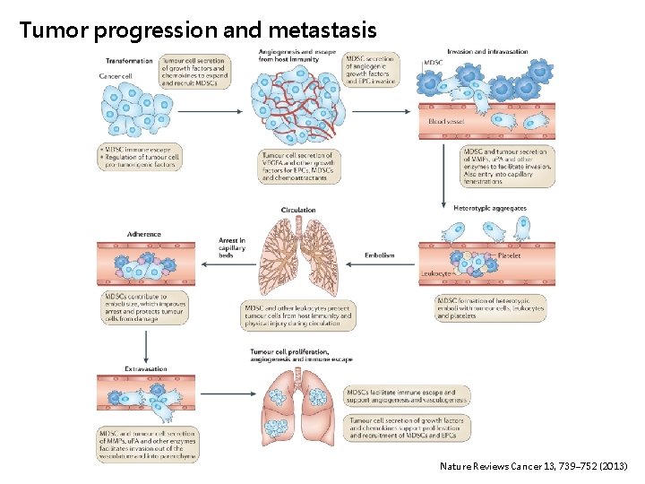 Tumor progression and metastasis Nature Reviews Cancer 13, 739– 752 (2013) 