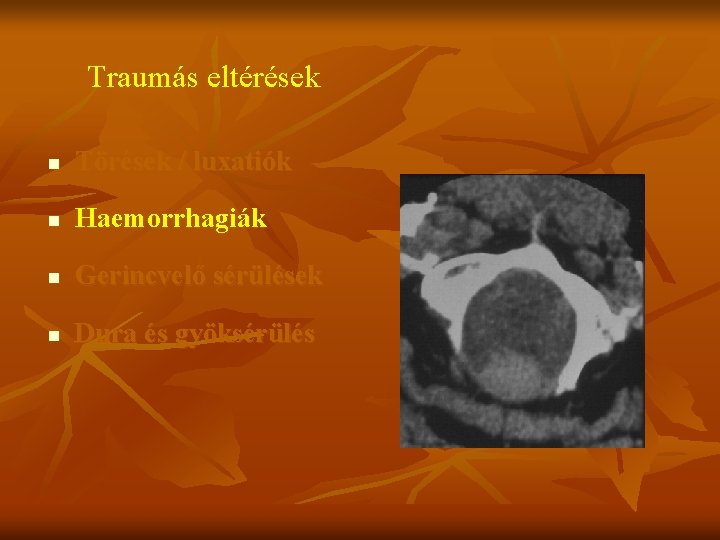 Traumás eltérések n Törések / luxatiók n Haemorrhagiák n Gerincvelő sérülések n Dura és