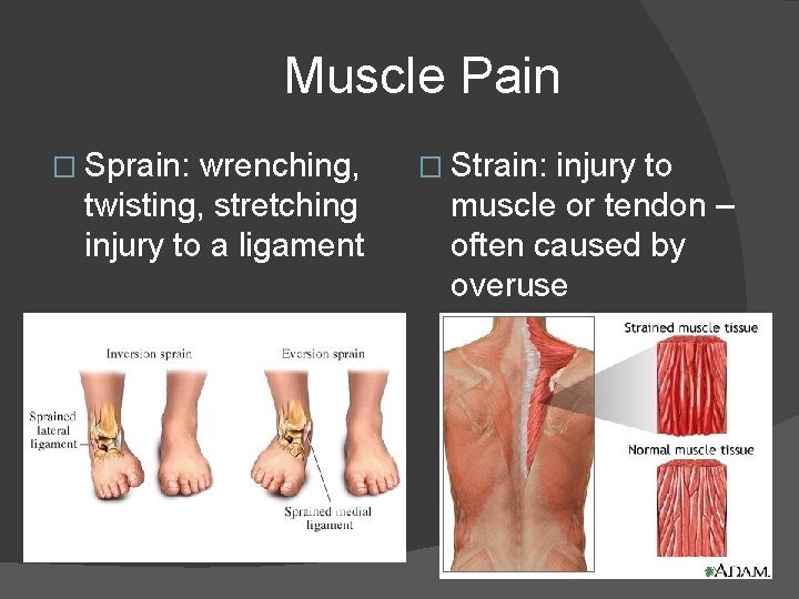 Muscle Pain � Sprain: wrenching, twisting, stretching injury to a ligament � Strain: injury