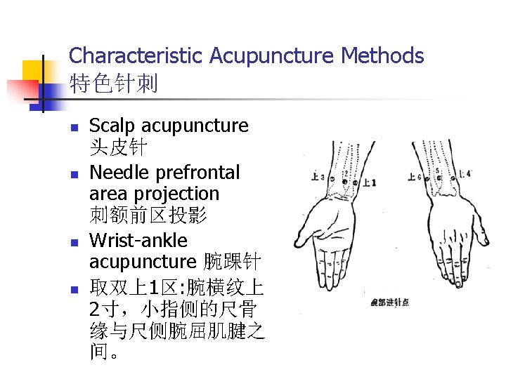 Characteristic Acupuncture Methods 特色针刺 n n Scalp acupuncture 头皮针 Needle prefrontal area projection 刺额前区投影