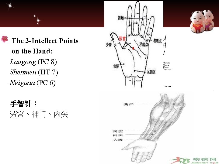  The 3 -Intellect Points on the Hand: Laogong (PC 8) Shenmen (HT 7)