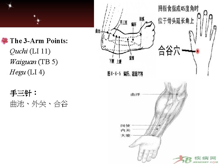 The 3 -Arm Points: Quchi (LI 11) Waiguan (TB 5) Hegu (LI 4) 手三针：