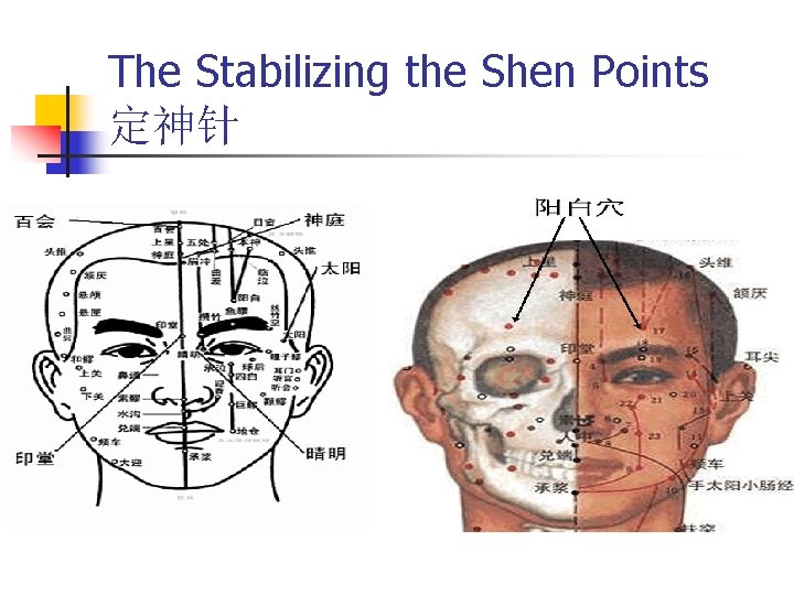 The Stabilizing the Shen Points 定神针 