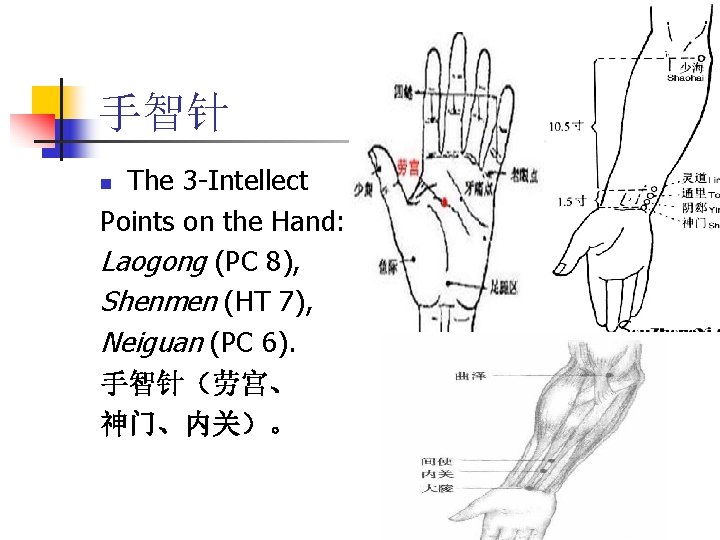 手智针 The 3 -Intellect Points on the Hand: Laogong (PC 8), Shenmen (HT 7),
