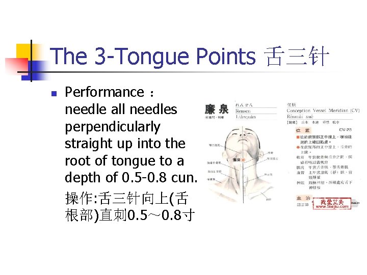 The 3 -Tongue Points 舌三针 n Performance ： needle all needles perpendicularly straight up