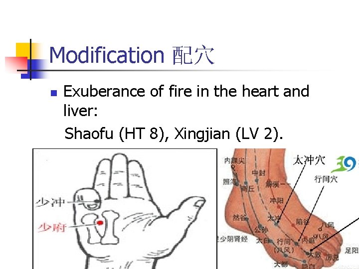 Modification 配穴 n Exuberance of fire in the heart and liver: Shaofu (HT 8),
