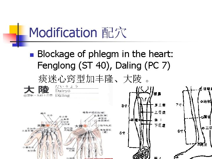Modification 配穴 n Blockage of phlegm in the heart: Fenglong (ST 40), Daling (PC