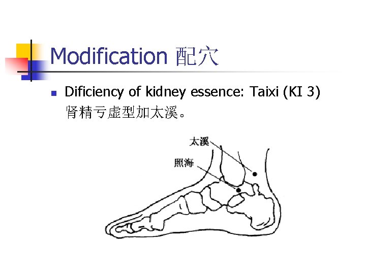 Modification 配穴 n Dificiency of kidney essence: Taixi (KI 3) 肾精亏虚型加太溪。 