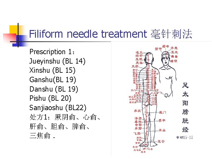 Filiform needle treatment 毫针刺法 Prescription 1： Jueyinshu (BL 14) Xinshu (BL 15) Ganshu(BL 19)