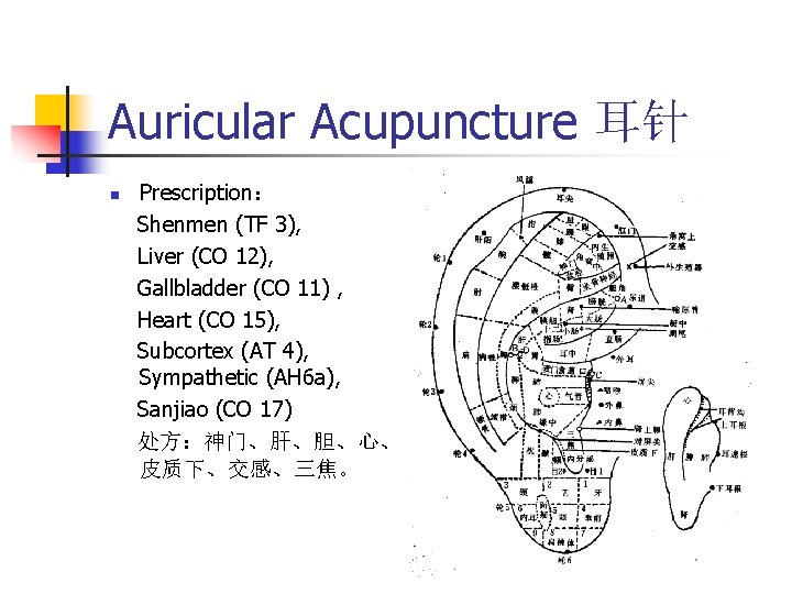 Auricular Acupuncture 耳针 n Prescription： Shenmen (TF 3), Liver (CO 12), Gallbladder (CO 11)