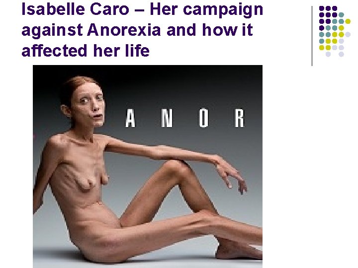 Isabelle Caro – Her campaign against Anorexia and how it affected her life Isabelle Caro – Her campaign against Anorexia and how it affected her life