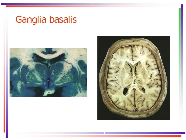 Ganglia basalis 