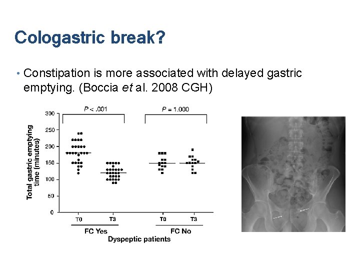 Cologastric break? • Constipation is more associated with delayed gastric emptying. (Boccia et al.