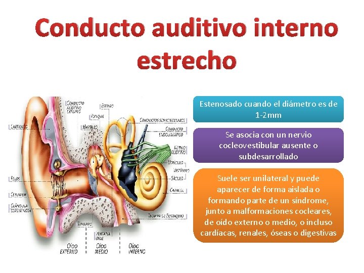 Conducto auditivo interno estrecho Estenosado cuando el diámetro es de 1 -2 mm Se