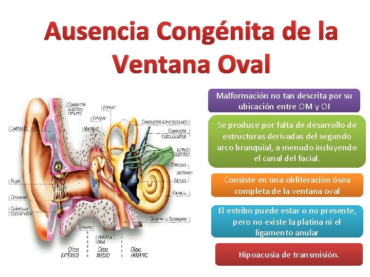 Ausencia Congénita de la Ventana Oval Malformación no tan descrita por su ubicación entre