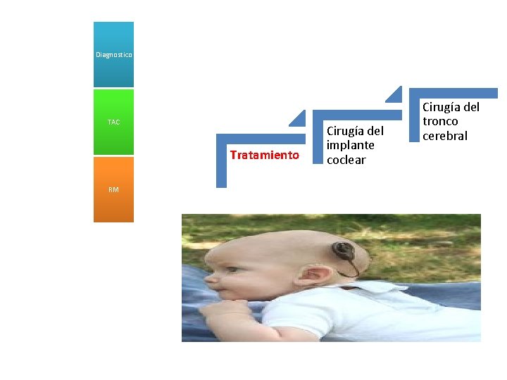 Diagnostico TAC Tratamiento RM Cirugía del implante coclear Cirugía del tronco cerebral 