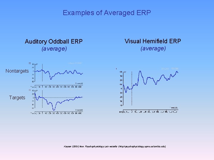 Examples of Averaged ERP Auditory Oddball ERP (average) Visual Hemifield ERP (average) Nontargets Targets