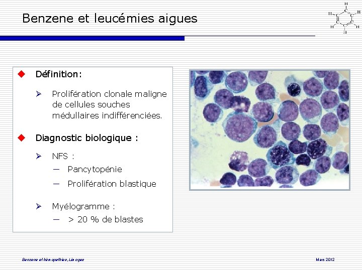 Benzene et leucémies aigues Définition: Prolifération clonale maligne de cellules souches médullaires indifférenciées. Diagnostic