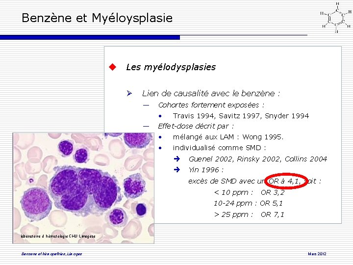 Benzène et Myéloysplasie Les myélodysplasies Lien de causalité avec le benzène : ― Cohortes