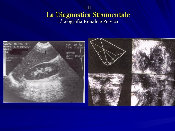 I. U. La Diagnostica Strumentale L’Ecografia Renale e Pelvica 