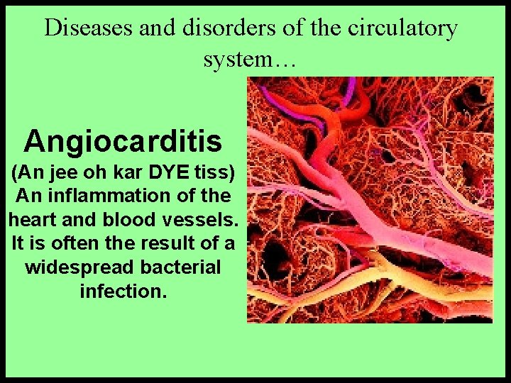 Diseases and disorders of the circulatory system… Angiocarditis (An jee oh kar DYE tiss)