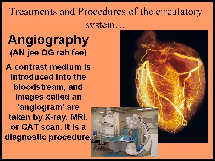 Treatments and Procedures of the circulatory system… Angiography (AN jee OG rah fee) A