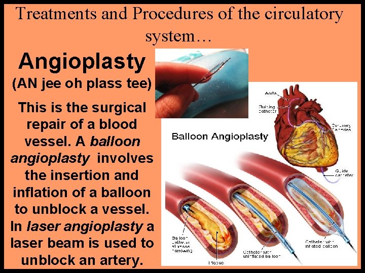 Treatments and Procedures of the circulatory system… Angioplasty (AN jee oh plass tee) This