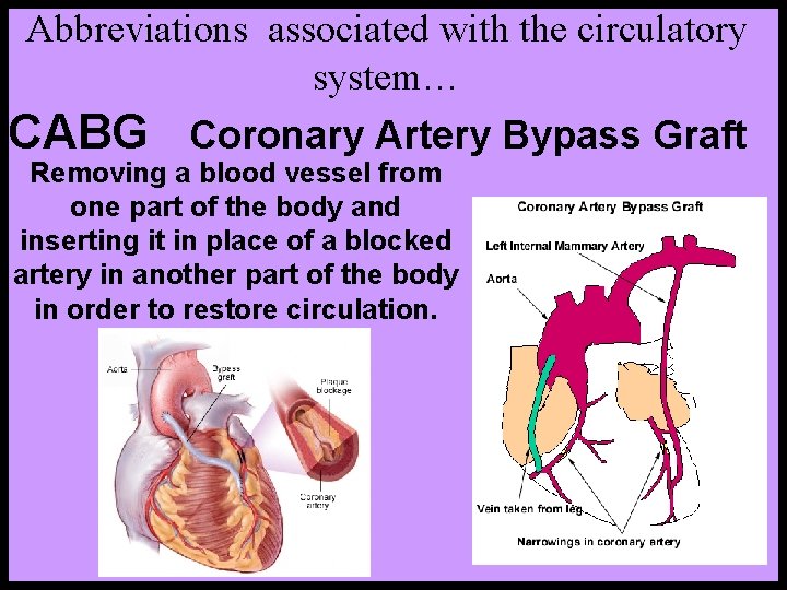 Abbreviations associated with the circulatory system… CABG Coronary Artery Bypass Graft Removing a blood