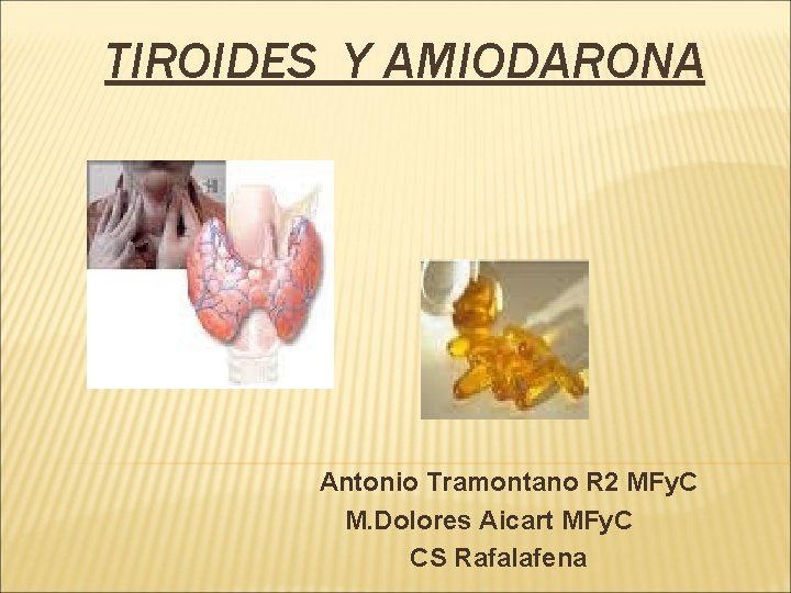 TIROIDES Y AMIODARONA Antonio Tramontano R 2 MFy. C M. Dolores Aicart MFy. C