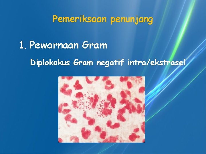 Pemeriksaan penunjang 1. Pewarnaan Gram Diplokokus Gram negatif intra/ekstrasel 