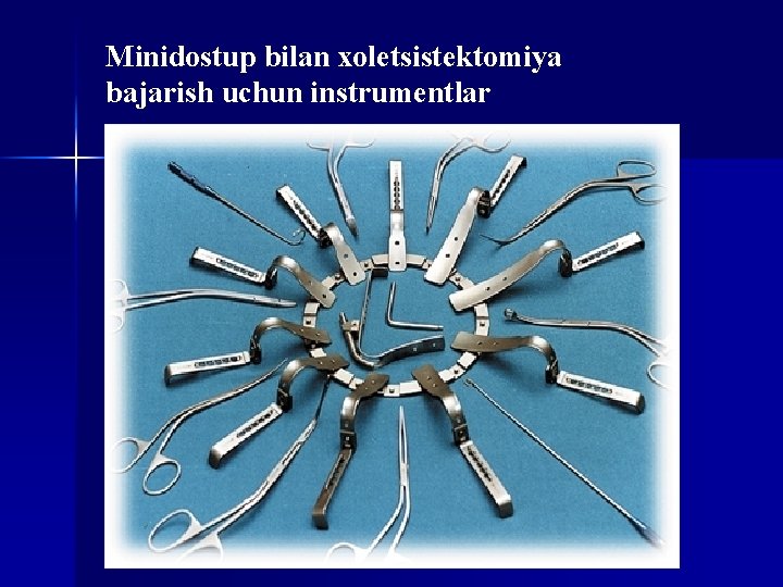 Minidostup bilan xoletsistektomiya bajarish uchun instrumentlar 