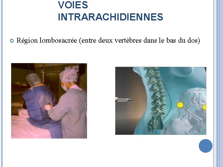 VOIES INTRARACHIDIENNES Région lombosacrée (entre deux vertèbres dans le bas du dos) 