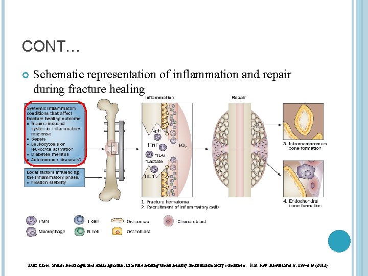 CONT… Schematic representation of inflammation and repair during fracture healing Lutz Claes, Stefan Recknagel