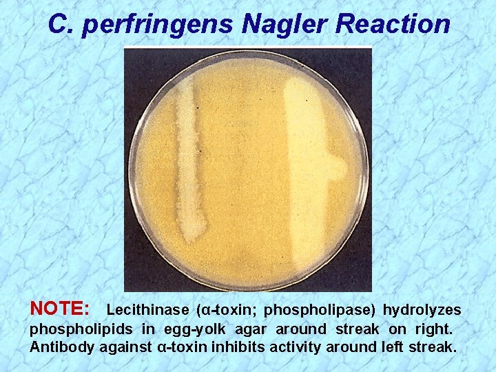 C. perfringens Nagler Reaction NOTE: Lecithinase (α-toxin; phospholipase) hydrolyzes phospholipids in egg-yolk agar around