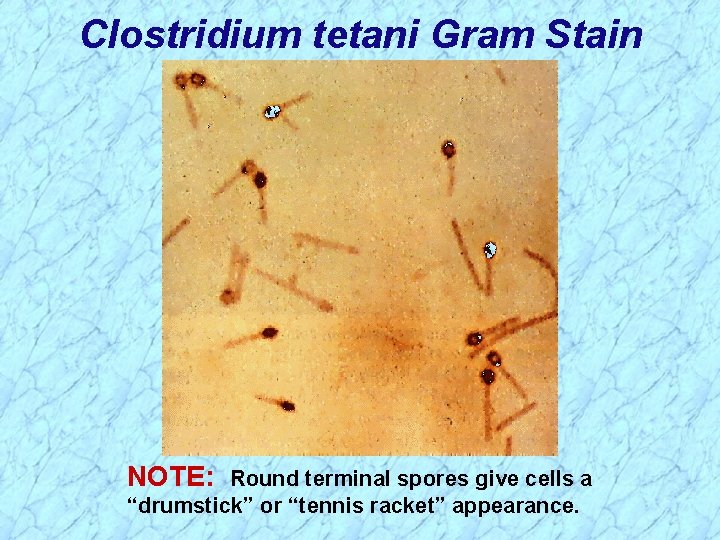 Clostridium tetani Gram Stain NOTE: Round terminal spores give cells a “drumstick” or “tennis